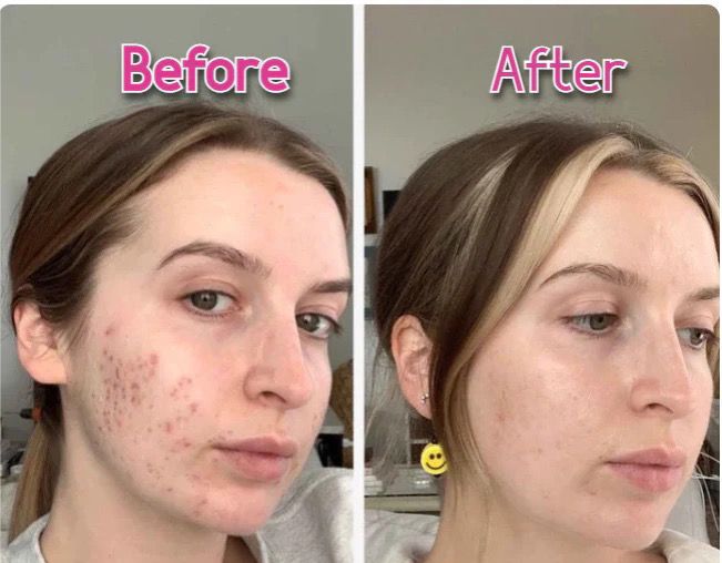 LED Face & Neck Wrinkle Massager! 7-in-1 Facial LED Sculptor  [With Free of Cost GIFT]