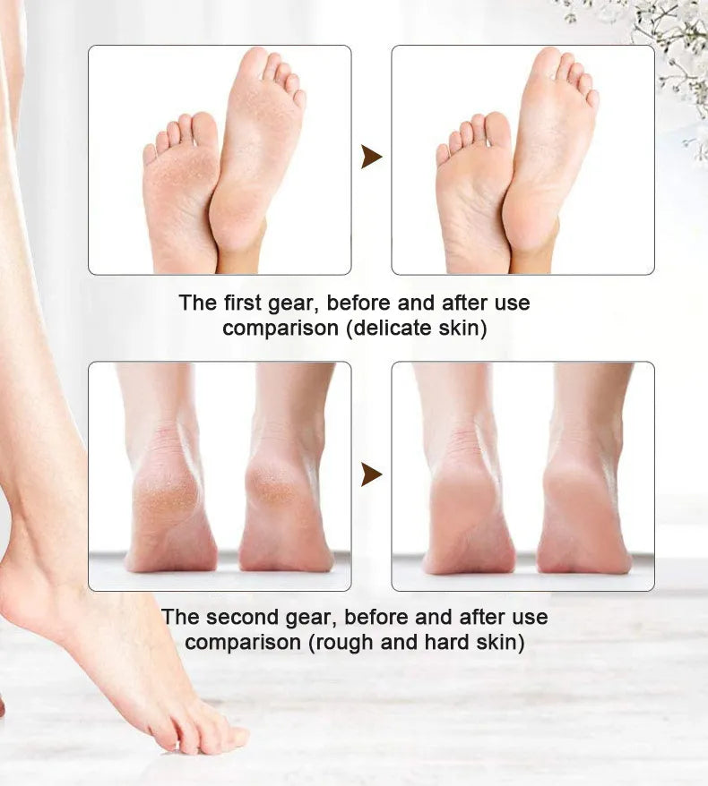 Rechargeable Electric Foot File Callus Remover Pedicure Machine Apparatus for Heels Grinding Device Foot Corns Remove Roller Feet Care